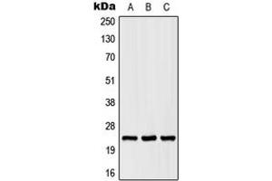 Western blot analysis of SCN2B expression in HEK293T (A), Raw264. (SCN2B antibody  (Center))