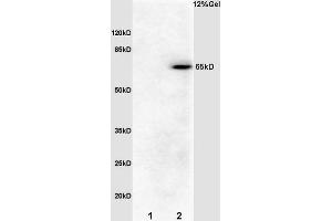 SDS-PAGE (SDS) image for anti-Cell Division Cycle 25 Homolog B (S. Pombe) (CDC25B) (pSer186) antibody (ABIN756967)