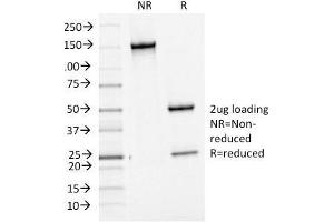 SDS-PAGE Analysis Purified bcl-6 Mouse Monoclonal Antibody (BCL6/1475). (BCL6 antibody  (AA 256-389))