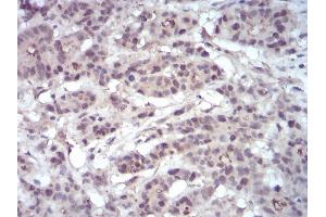 Immunohistochemistry (IHC) image for anti-Enhancer of Zeste Homolog 2 (EZH2) (AA 1-194) antibody (ABIN5542715)