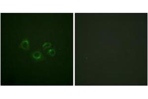 Immunofluorescence analysis of A549 cells, using EPHA2/3/4 (Ab-588/596) Antibody.