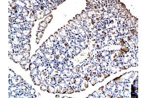 Formalin-fixed and paraffin embedded rat pancreatic tissue labeled with Anti-GIP Polyclonal Antibody, Unconjugated (ABIN724850) at 1:200, followed by conjugation to the secondary antibody and DAB staining