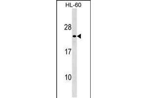 Western blot analysis in HL-60 cell line lysates (35ug/lane). (Membrane-Spanning 4-Domains, Subfamily A, Member 8 (MS4A8) (AA 44-70), (N-Term) antibody)