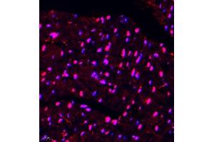 Immunofluorescence of paraffin embedded mouse heart using DGKI (ABIN7073721) at dilution of 1:650 (400x lens)