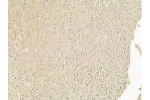 ABIN6266026 and ABIN6277560 at 1/100 staining human normal liver tissue by IHC-P.