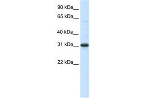 Western Blotting (WB) image for anti-Nuclear Receptor Interacting Protein 2 (NRIP2) antibody (ABIN2461500) (NRIP2 antibody)