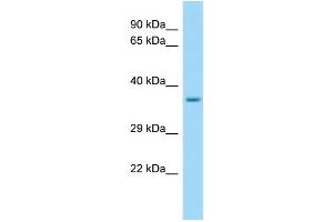 WB Suggested Anti-SELPLG Antibody Titration: 1. (SELPLG antibody  (C-Term))