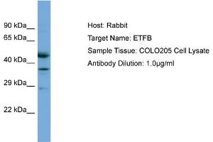 Host: Rabbit Target Name: ETFB Sample Tissue: Human COLO205 Whole Cell Antibody Dilution: 1ug/ml