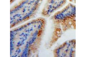 Immunohistochemistry (IHC) image for anti-Fatty Acid Binding Protein 2, Intestinal (FABP2) (AA 2-132) antibody (ABIN1078014)