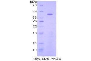 SDS-PAGE analysis of Mouse STAP1 Protein. (STAP1 Protein)