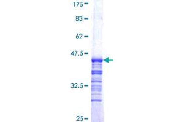 DDX1 Protein (AA 642-740) (GST tag)