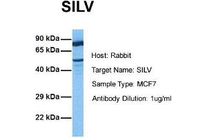 Host:  Rabbit  Target Name:  SILV  Sample Tissue:  Human MCF7  Antibody Dilution:  1.