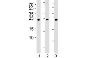 Western blot analysis of lysate from 1) 293, 2) SW620, and 3) U-87 MG cell line using UCHL3 antibody at 1:1000. (UCHL3 antibody  (AA 195-225))