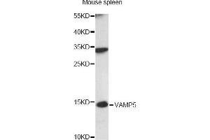 Western blot analysis of extracts of mouse spleen, using VAMP5 antibody (ABIN6292345) at 1:3000 dilution.