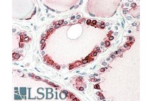 ABIN768643 (5µg/ml) staining of paraffin embedded Human Thyroid Gland. (Thyroperoxidase antibody  (C-Term))