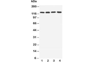 Western blot testing of TLR7 antibody and Lane 1:  rat spleen;  2: rat liver;  3: U87;  4: A549 cell lysate (TLR7 antibody  (C-Term))