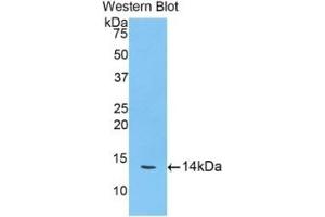 WB of Protein Standard: different control antibodies against Highly purified E. (Cathepsin D ELISA Kit)