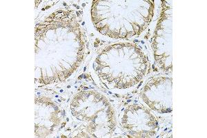 Immunohistochemistry of paraffin-embedded human stomach using HPS1 antibody at dilution of 1:100 (x40 lens). (HPS1 antibody)