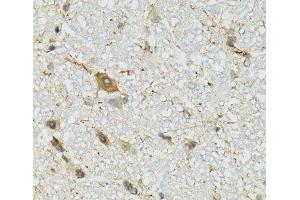 Immunohistochemistry of paraffin-embedded Mouse brain using COQ3 Polyclonal Antibody at dilution of 1:100 (40x lens). (COQ3 antibody)