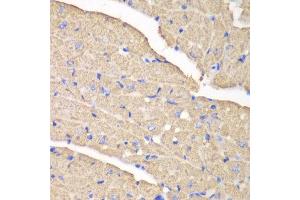 Immunohistochemistry of paraffin-embedded mouse heart using VDAC1 antibody at dilution of 1:100 (400x lens). (VDAC1 antibody)