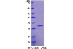 SDS-PAGE analysis of Human RBM20 Protein. (RBM20 Protein)