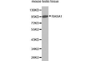 Western Blotting (WB) image for anti-RAS P21 Protein Activator (GTPase Activating Protein) 1 (RASA1) (AA 140-220) antibody (ABIN6218715) (RASA1 antibody  (AA 140-220))
