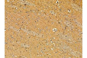 ABIN7095633 and ABIN7099695 at 1/100 staining rat brain tissue by IHC-P. (POU6F1 antibody)