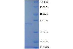 SDS-PAGE (SDS) image for Tryptase beta 2 (TPSB2) (AA 30-274) protein (His tag) (ABIN7586385)