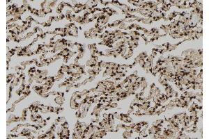 ABIN6279212 at 1/100 staining Human lung tissue by IHC-P. (PDE1A antibody  (Internal Region))
