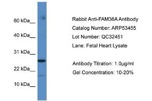WB Suggested Anti-FAM36A Antibody Titration: 0. (FAM36A antibody  (C-Term))