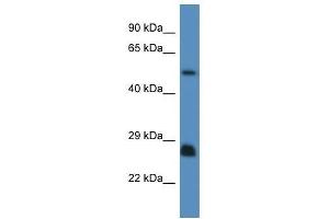 Western Blot showing Shc3 antibody used at a concentration of 1. (SHC3 antibody  (N-Term))