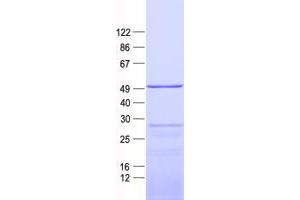 Western Blotting (WB) image for Mitochondrial Ribosomal Protein S27 (MRPS27) protein (His tag) (ABIN2726398)