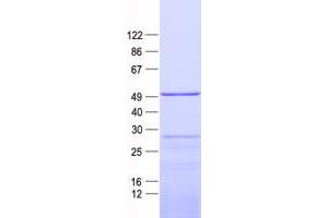 Validation with Western Blot (MRPS27 Protein (His tag))