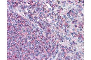 IHC-P Image Immunohistochemical analysis of paraffin-embedded human Spleen, using gamma Actin, antibody(10 μg/ml). (Actin, gamma 1 antibody  (N-Term))