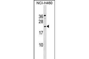 GLIPR1L1 Antibody (C-term) (ABIN1536826 and ABIN2849524) western blot analysis in NCI- cell line lysates (35 μg/lane). (GLIPR1L1 antibody  (C-Term))