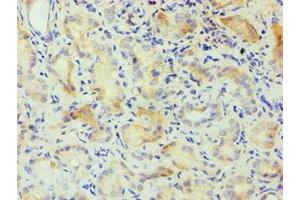Immunohistochemistry of paraffin-embedded human kidney tissue using ABIN7146856 at dilution of 1:100 (CSNK1A1L antibody  (Isoform alpha))