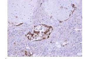 Figure 2. (SOCS5 antibody  (N-Term))