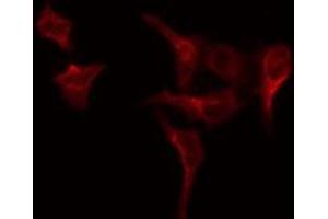 ABIN6275001 staining COLO205 by IF/ICC. (CLCC1 antibody  (Internal Region))