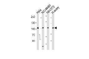 Western blot analysis of lysates from Hela, NCI-H460, mouse NIH/3T3 cell line and human ovary tissue lysate (from left to right), using EPHA4 Antibody (R890) at 1:1000 at each lane. (EPH Receptor A4 antibody  (C-Term))