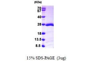 SDS-PAGE (SDS) image for RAP1B, Member of RAS Oncogene Family (RAP1B) (AA 1-181) protein (His tag) (ABIN667867) (RAP1B Protein (AA 1-181) (His tag))