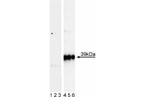Western blot analysis of c-Jun (pS63) in human vascular endothelium. (C-JUN antibody  (pSer63))
