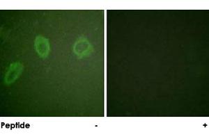 Immunofluorescence analysis of HUVEC cells, using ERBB2 polyclonal antibody . (ErbB2/Her2 antibody)