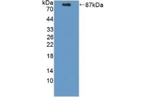 Detection of Recombinant PCSK9, Mouse using Polyclonal Antibody to Proprotein Convertase Subtilisin/Kexin Type 9 (PCSK9) (PCSK9 antibody  (AA 156-694))