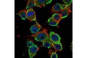 Immunofluorescence analysis of PANC-1 cells using CEA mouse mAb (green). (CEA antibody)
