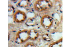 Used in DAB staining on fromalin fixed paraffin-embedded Kidney tissue (IGF1R antibody  (AA 763-955))