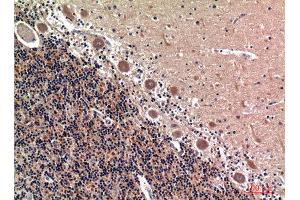 Immunohistochemistry (IHC) analysis of paraffin-embedded Human Brain, antibody was diluted at 1:100. (RSAD2 antibody  (Internal Region))