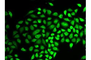 Immunofluorescence analysis of HeLa cell using USP7 antibody. (USP7 antibody  (AA 206-1102))