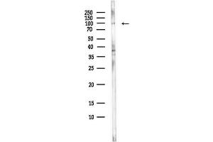 Western blot analysis of lysates from Hela cells(starvation,24h treatment), using Phospho-NF kappaB p100/p52 (Ser872) Antibody at 1/1000 dilution.