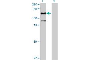 Western Blot analysis of STK31 expression in transfected 293T cell line by STK31 monoclonal antibody (M02), clone 1C10.
