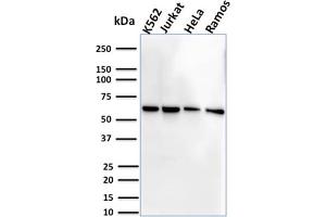 Western Blot Analysis of Human K562, Jurkat, HeLa and Ramos cell lysate using CD127 Mouse Monoclonal Antibody (IL7R/2751). (IL7R antibody  (AA 21-236))